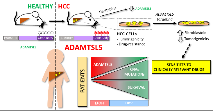 The scheme illustrates how in healthy liver (both mouse and human), ADAMTSL5 is expressed at very low levels due to the absence of methylation in the gene body CpG island. Instead, in HCC, ADAMTSL5 is overexpressed due to gene body CpG island hypermethylation. Top: ADAMTSL5 confers tumorigenicity and drug-resistance to HCC cells while its targeting resulted in sensitization to clinically relevant drugs. Additionally, demethylating agents (Decitabine) reduces ADAMTSL5 expression in HCC cells. Bottom: In HCC patients, ADAMTSL5 overexpression correlates with worse prognosis, reduced genetic alterations, and with alcohol consumption as a main risk factor in HCC patients.