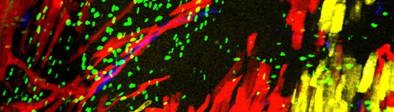 Polyclonal growth of the ventricular conduction system.